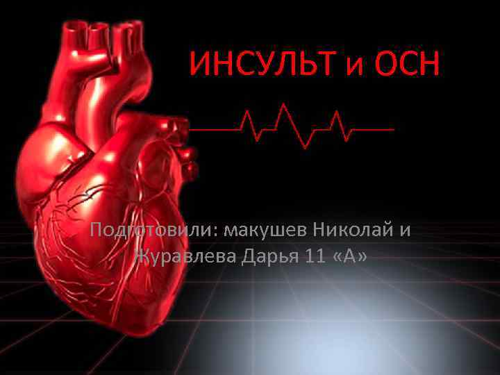 ИНСУЛЬТ и ОСН Подготовили: макушев Николай и Журавлева Дарья 11 «А» 