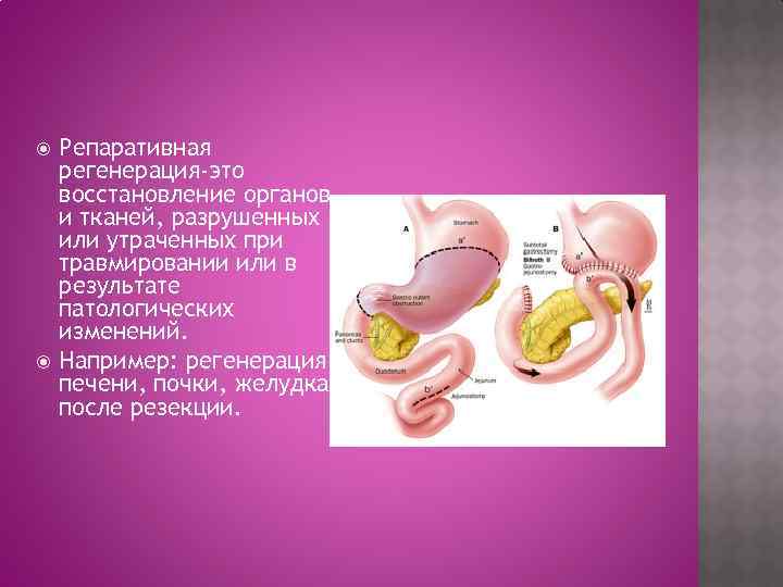 Гетероморфоз. Регенерация органов. Репаративная регенерация. Восстановление органов и тканей. Репаративная регенерация тканей.