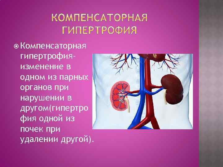  Компенсаторная гипертрофияизменение в одном из парных органов при нарушении в другом(гипертро фия одной