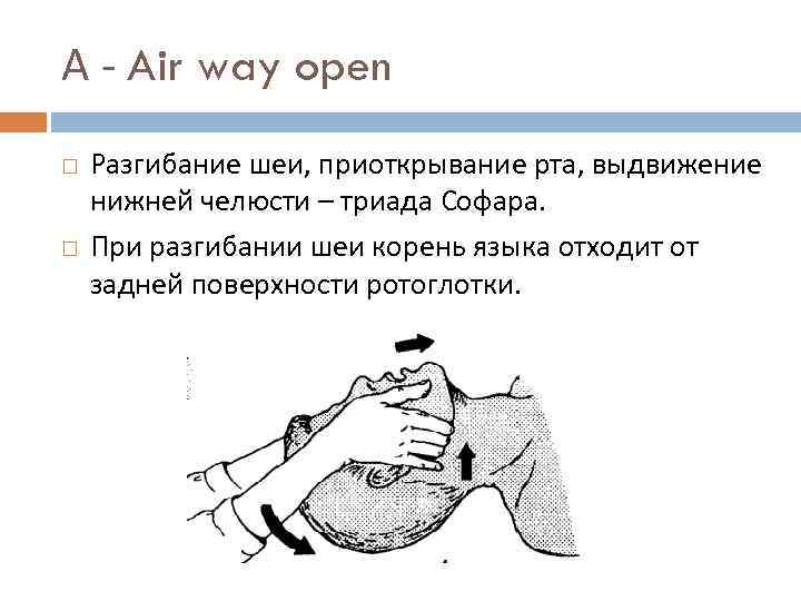 А - Air way open Разгибание шеи, приоткрывание рта, выдвижение нижней челюсти – триада