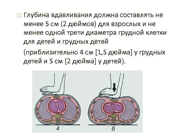  Глубина вдавливания должна составлять не менее 5 см (2 дюймов) для взрослых и