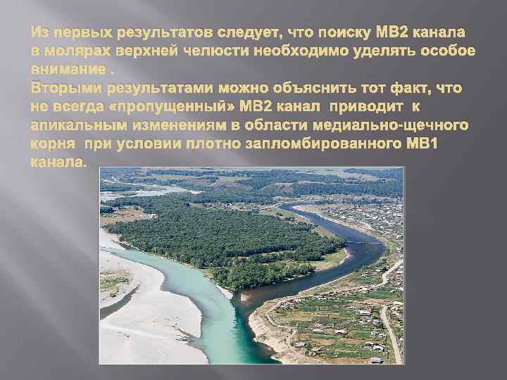 Из первых результатов следует, что поиску МВ 2 канала в молярах верхней челюсти необходимо