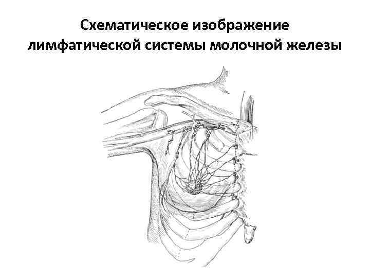 Схематическое изображение лимфатической системы молочной железы 