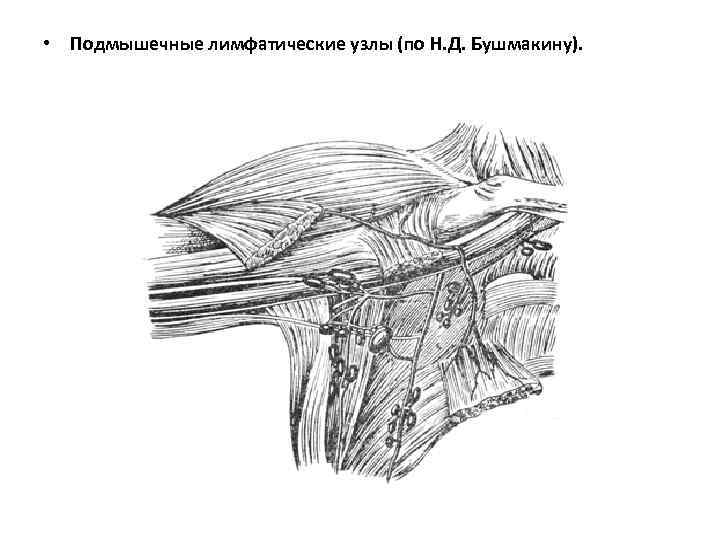 Где находятся лимфоузлы в подмышках схема у женщин