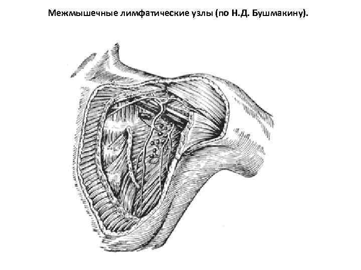 Межмышечные лимфатические узлы (по Н. Д. Бушмакину). 