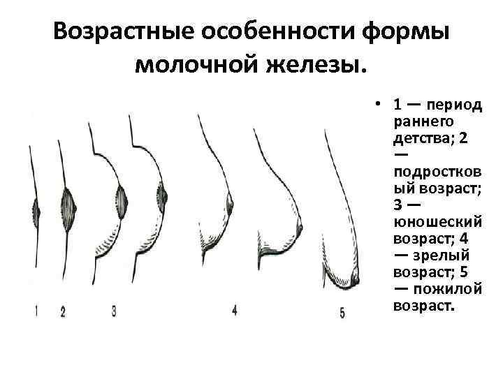 Возрастные особенности формы молочной железы. • 1 — период раннего детства; 2 — подростков