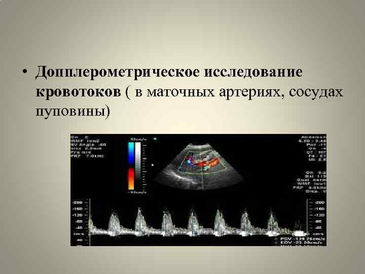  • Допплерометрическое исследование кровотоков ( в маточных артериях, сосудах пуповины) 