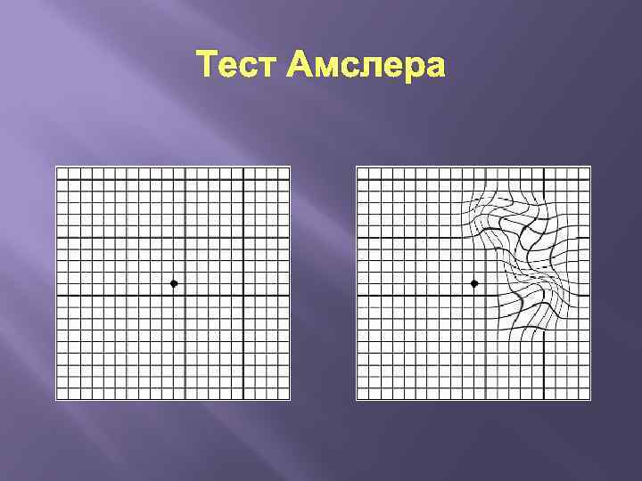 Тест Амслера 