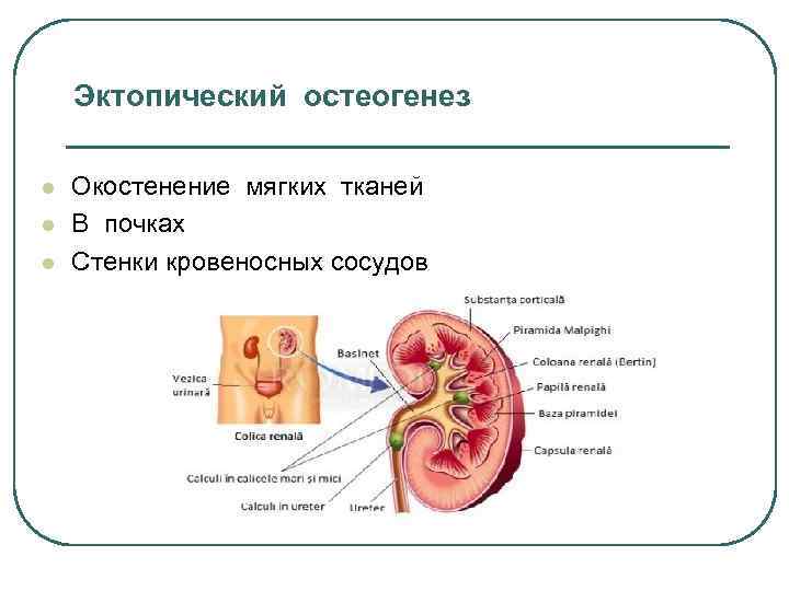 Эктопический остеогенез l l l Окостенение мягких тканей В почках Стенки кровеносных сосудов 