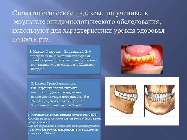 Стоматологические индексы, полученные в результате эпидемиологического обследования, используют для характеристики уровня здоровья полости рта.