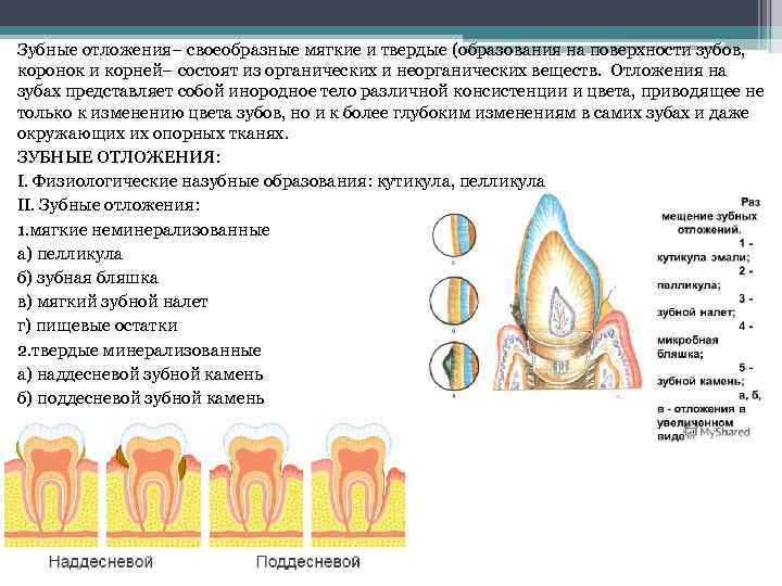 Зубные отложения– своеобразные мягкие и твердые (образования на поверхности зубов, коронок и корней– состоят