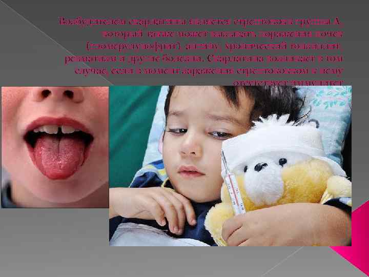 Возбудителем скарлатины является стрептококк группы А, который также может вызывать поражения почек (гломерулунофрит), ангину,