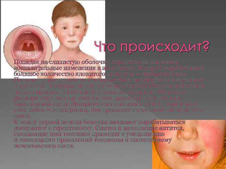 Что происходит? Попадая на слизистую оболочку, стрептококк вызывает воспалительные изменения в носоглотке. Микроб вырабатывает