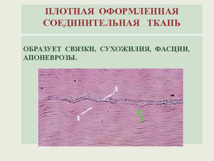 ПЛОТНАЯ ОФОРМЛЕННАЯ СОЕДИНИТЕЛЬНАЯ ТКАНЬ ОБРАЗУЕТ СВЯЗКИ, СУХОЖИЛИЯ, ФАСЦИИ, АПОНЕВРОЗЫ. 