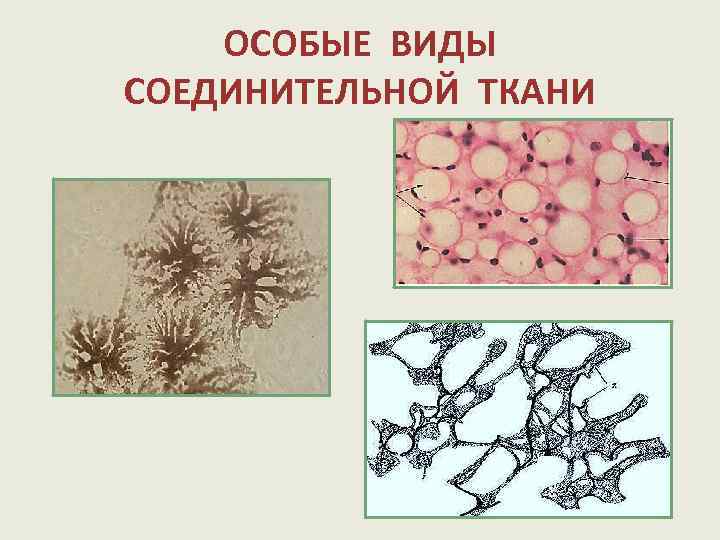 Вид соединительной. Жировая ретикулярная и пигментная слизистая ткань. Подвиды соединительной ткани. Особые виды соединительной ткани. Пигментная ткань человека.