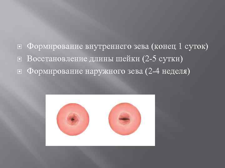  Формирование внутреннего зева (конец 1 суток) Восстановление длины шейки (2 5 сутки) Формирование
