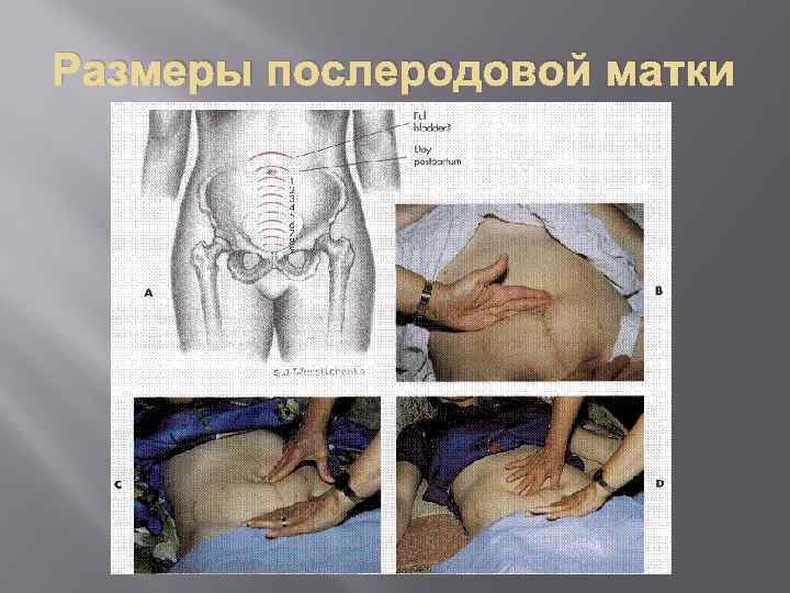 Размеры послеродовой матки 