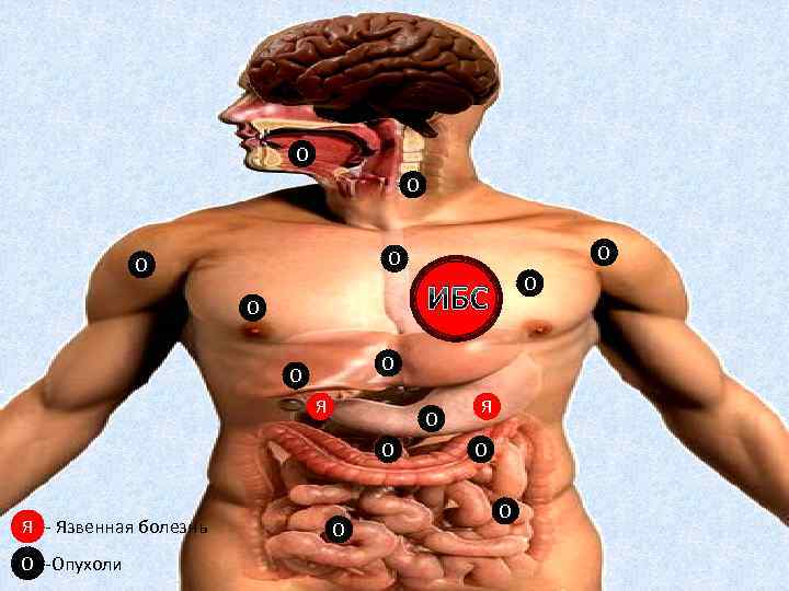 О О Я О О О -Опухоли О ИБС О Я - Язвенная болезнь