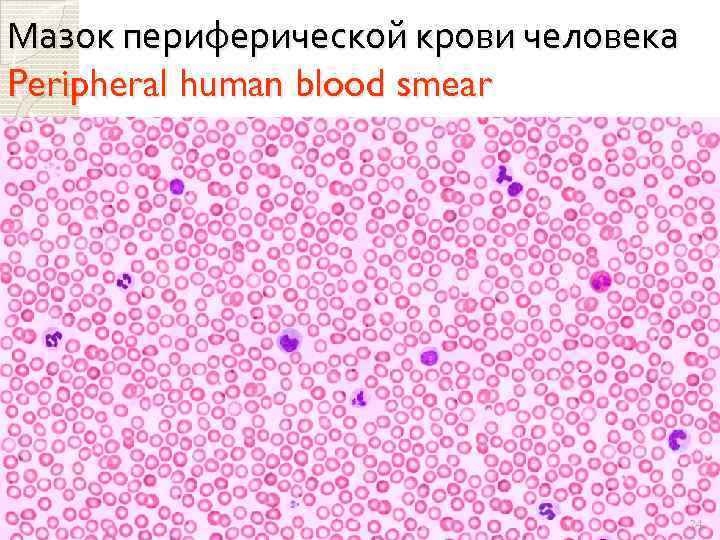 Мазок периферической крови человека Peripheral human blood smear 24 