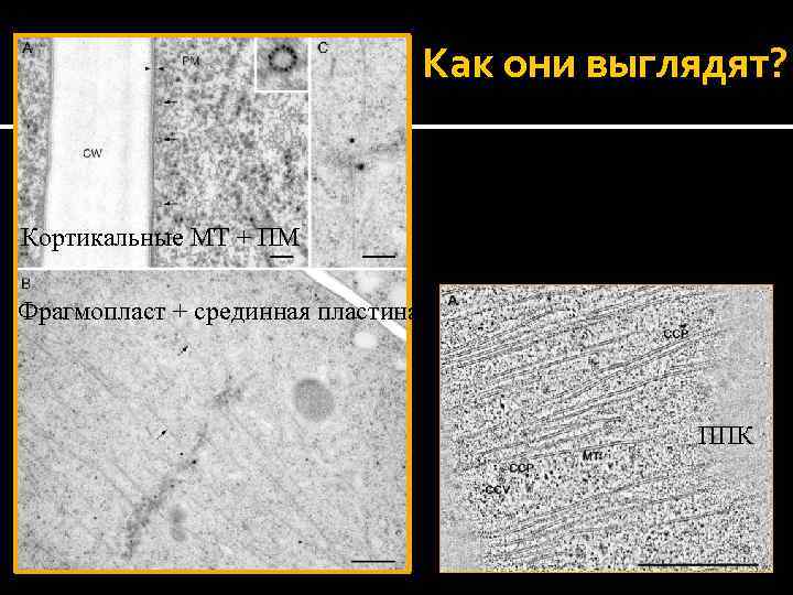 Как они выглядят? Кортикальные МТ + ПМ Фрагмопласт + срединная пластина ППК 