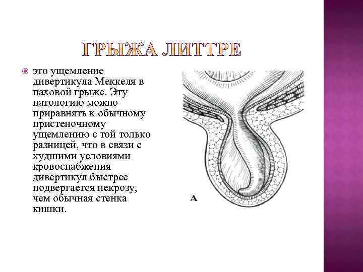 Ущемленная паховая грыжа у детей карта вызова смп