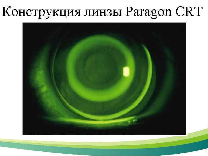 Конструкция линзы Paragon CRT 
