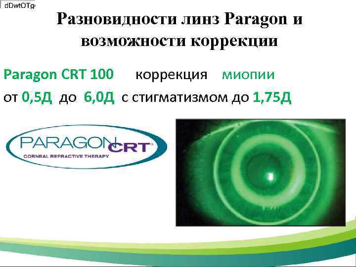 Разновидности линз Paragon и возможности коррекции Paragon CRT 100 коррекция миопии от 0, 5