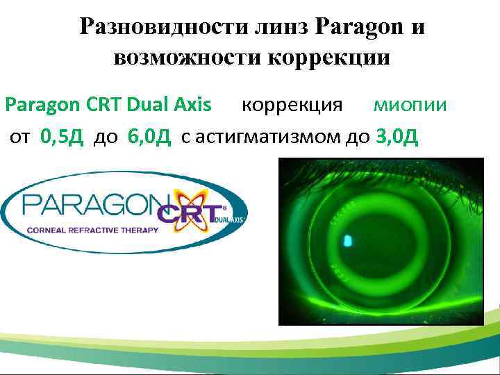 Разновидности линз Paragon и возможности коррекции Paragon CRT Dual Axis коррекция миопии от 0,