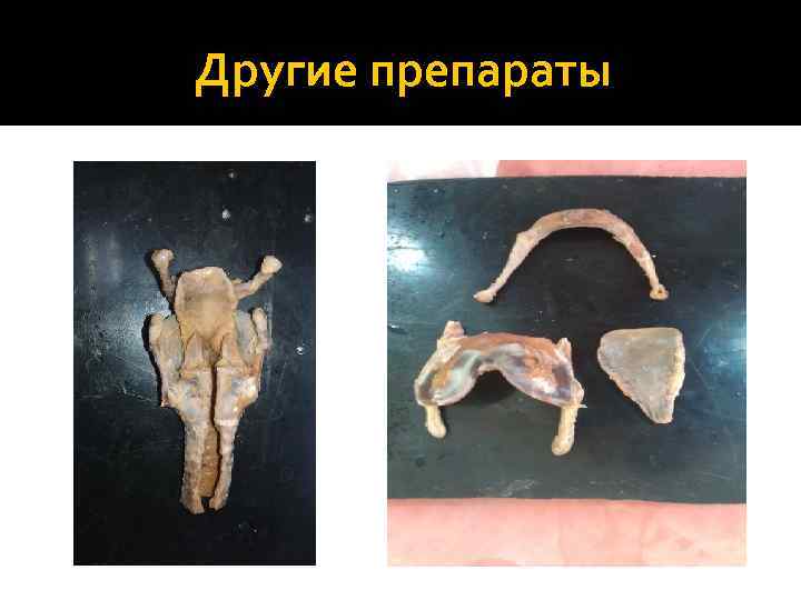 Другие препараты 