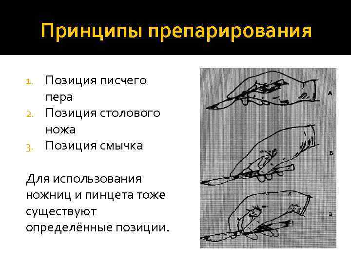 Принципы препарирования Позиция писчего пера 2. Позиция столового ножа 3. Позиция смычка 1. Для