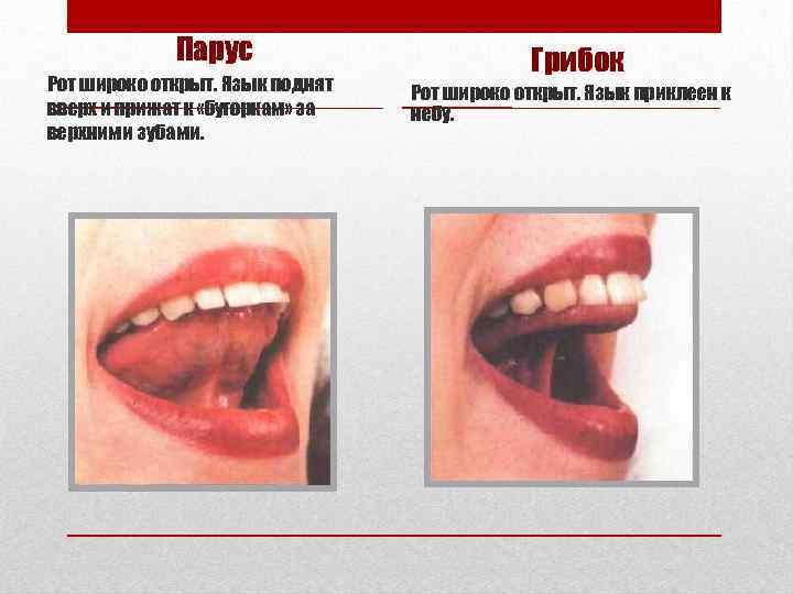 Парус Рот широко открыт. Язык поднят вверх и прижат к «бугоркам» за верхними зубами.