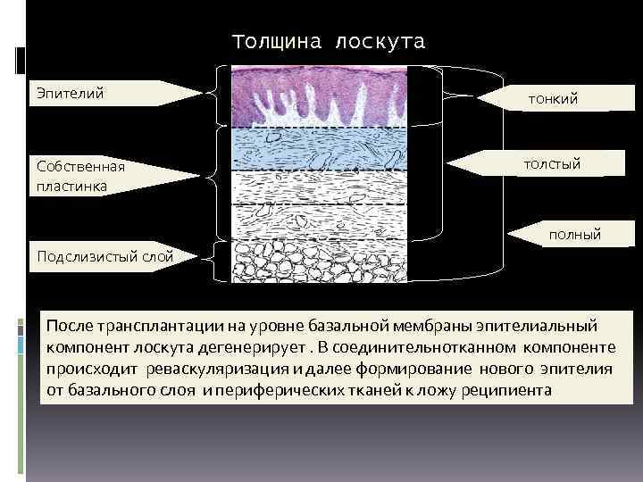 Толщина лоскута Эпителий Собственная пластинка тонкий толстый полный Подслизистый слой После трансплантации на уровне