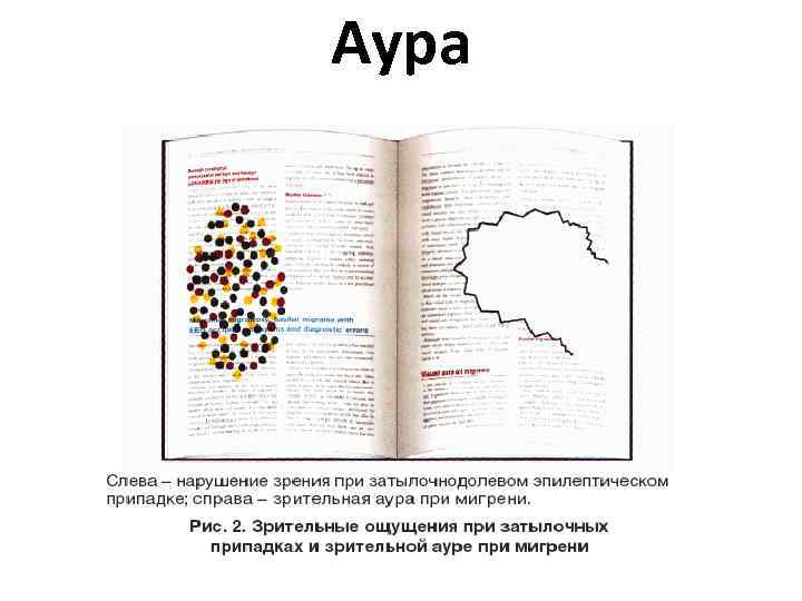 Аура 