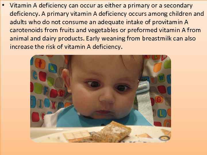  • Vitamin A deficiency can occur as either a primary or a secondary