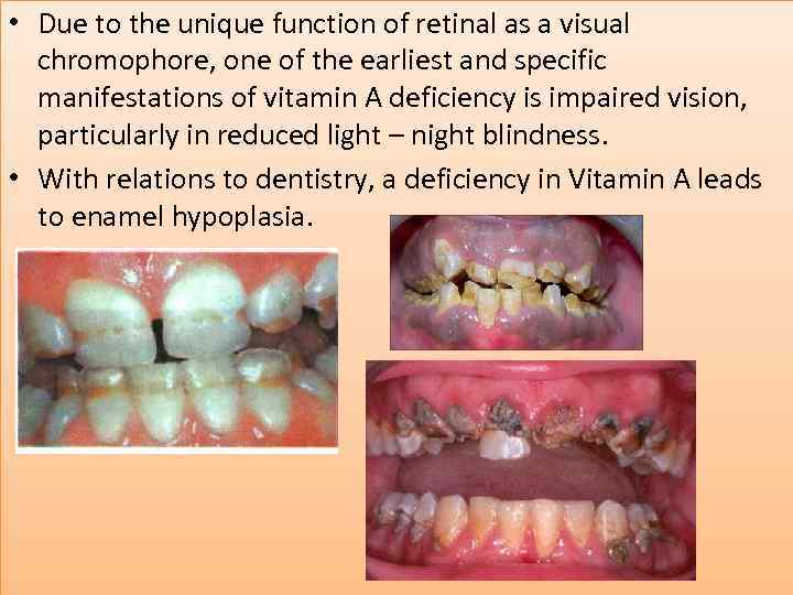  • Due to the unique function of retinal as a visual chromophore, one