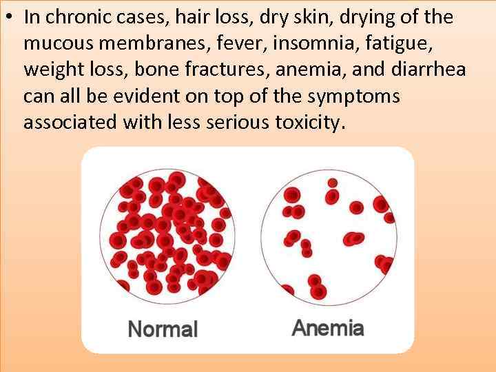  • In chronic cases, hair loss, dry skin, drying of the mucous membranes,