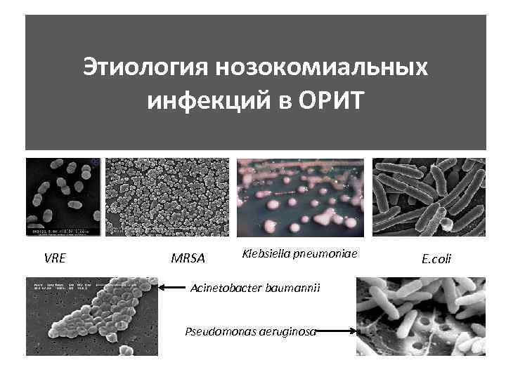 Этиология нозокомиальных инфекций в ОРИТ VRE MRSA Klebsiella pneumoniae Acinetobacter baumannii Pseudomonas aeruginosa E.