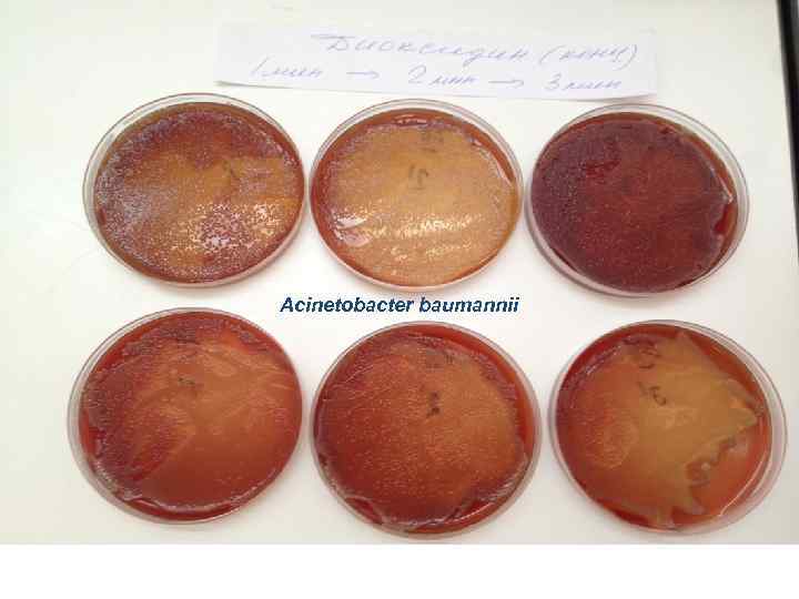 Acinetobacter baumannii 