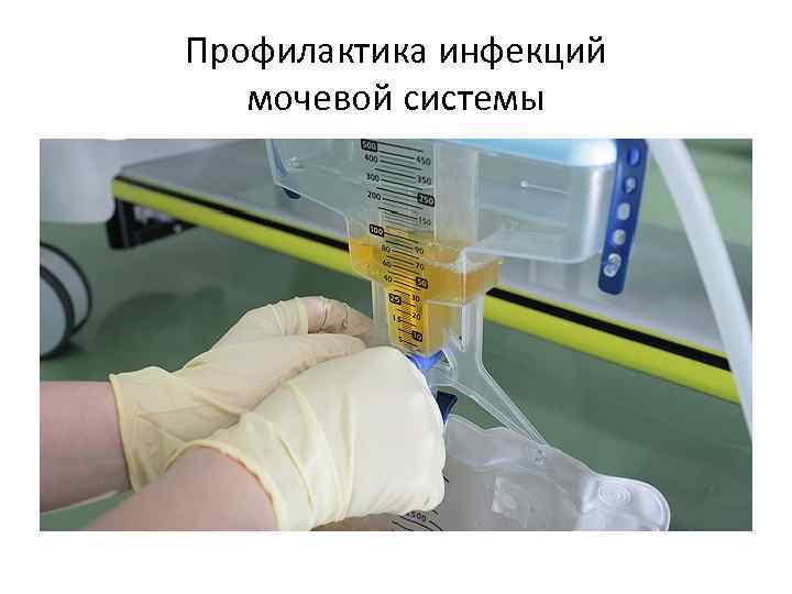 Профилактика инфекций мочевой системы 