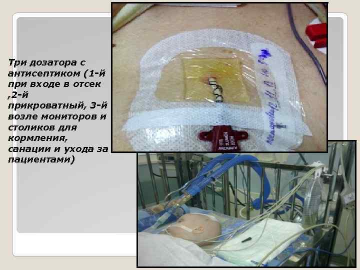 Три дозатора с антисептиком (1 -й при входе в отсек , 2 -й прикроватный,