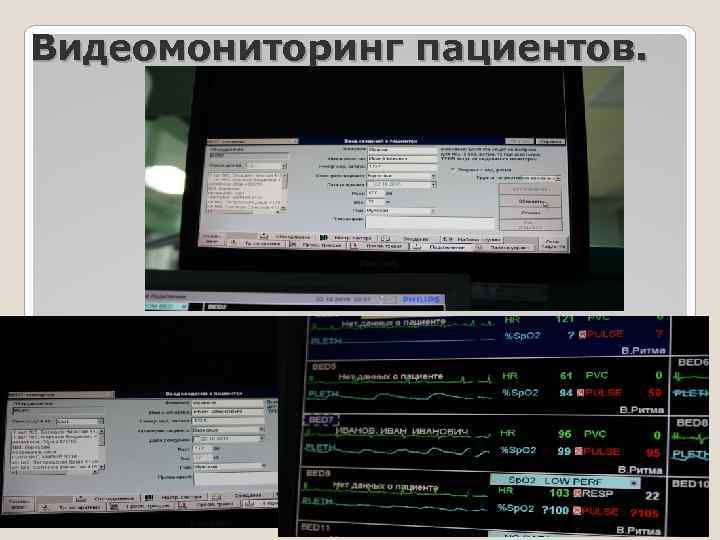 Видеомониторинг пациентов. 