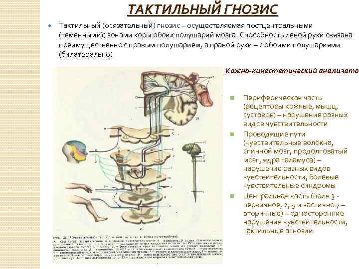 Зрительный гнозис картинки