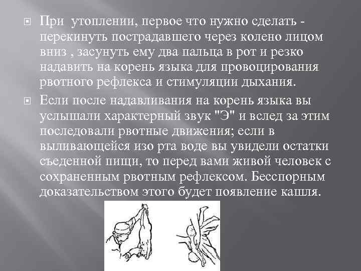  При утоплении, первое что нужно сделать перекинуть пострадавшего через колено лицом вниз ,