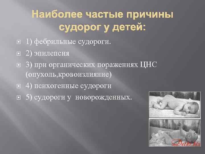 Наиболее частые причины судорог у детей: 1) фебрильные судороги. 2) эпилепсия 3) при органических