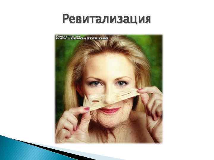 Ревитализация 