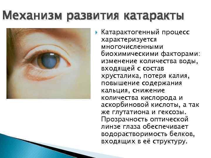 Причины заболевания катаракты