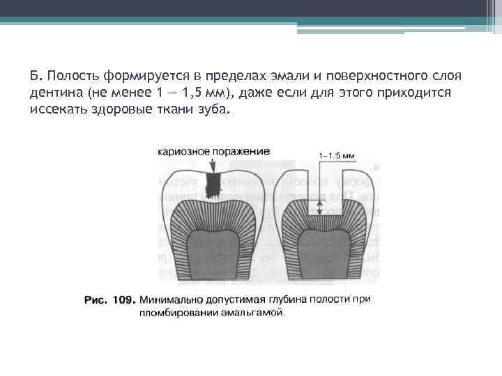 Б. Полость формируется в пределах эмали и поверхностного слоя дентина (не менее 1 —