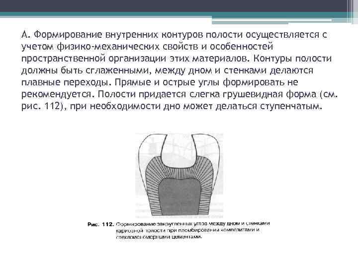 А. Формирование внутренних контуров полости осуществляется с учетом физико-механических свойств и особенностей пространственной организации