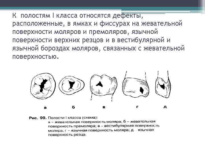 Принципы препарирования кариозных полостей