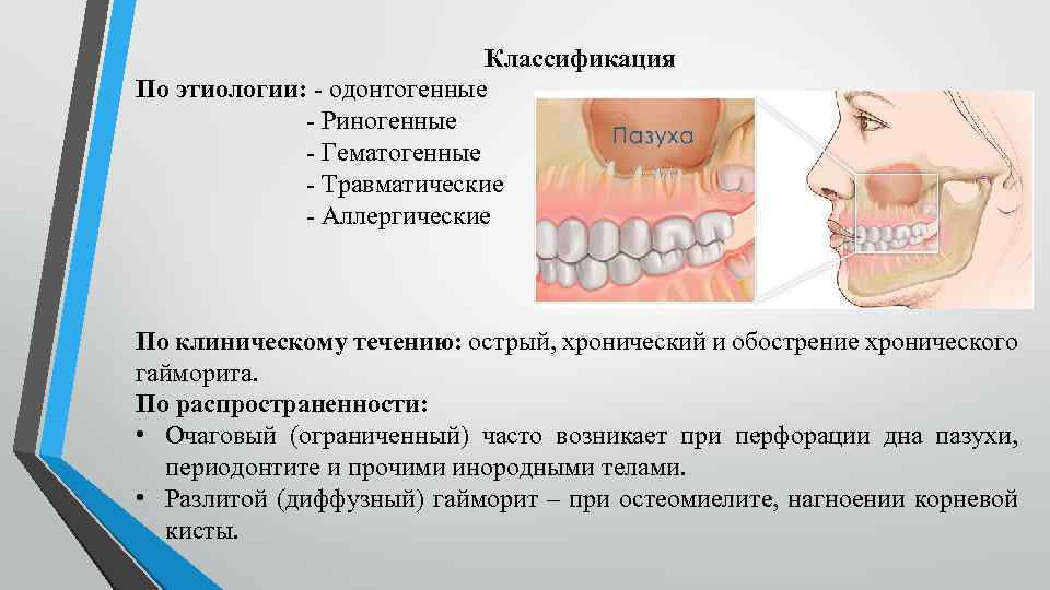 Классификация По этиологии: - одонтогенные - Риногенные - Гематогенные - Травматические - Аллергические По